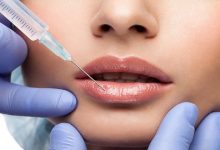 Lip Fillers - Side Effects & Benefits